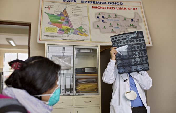 A doctor examines an X-ray of Tamara’s lungs. Shortly after getting on HIV medication, Tamara was diagnosed with Tuberculosis.